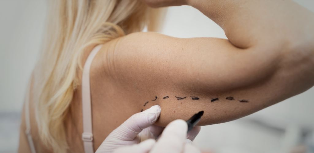 Lipo a laser não é só pra abdômen